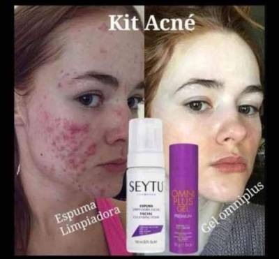 Kit Anti acné Seytu Foto